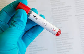 BVBNĐ triển khai xét nghiệm chẩn đoán viêm gan siêu vi D
